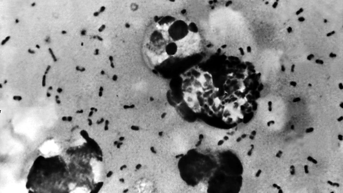 Featured image for "Fatal Bubonic Plague Case in New Mexico Raises Concerns"
