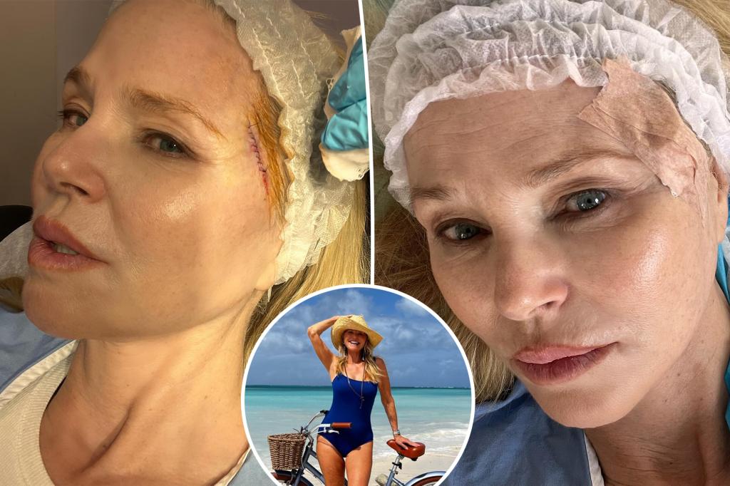Featured image for Christie Brinkley's Skin Cancer Diagnosis and Surgery: A Revealing Journey