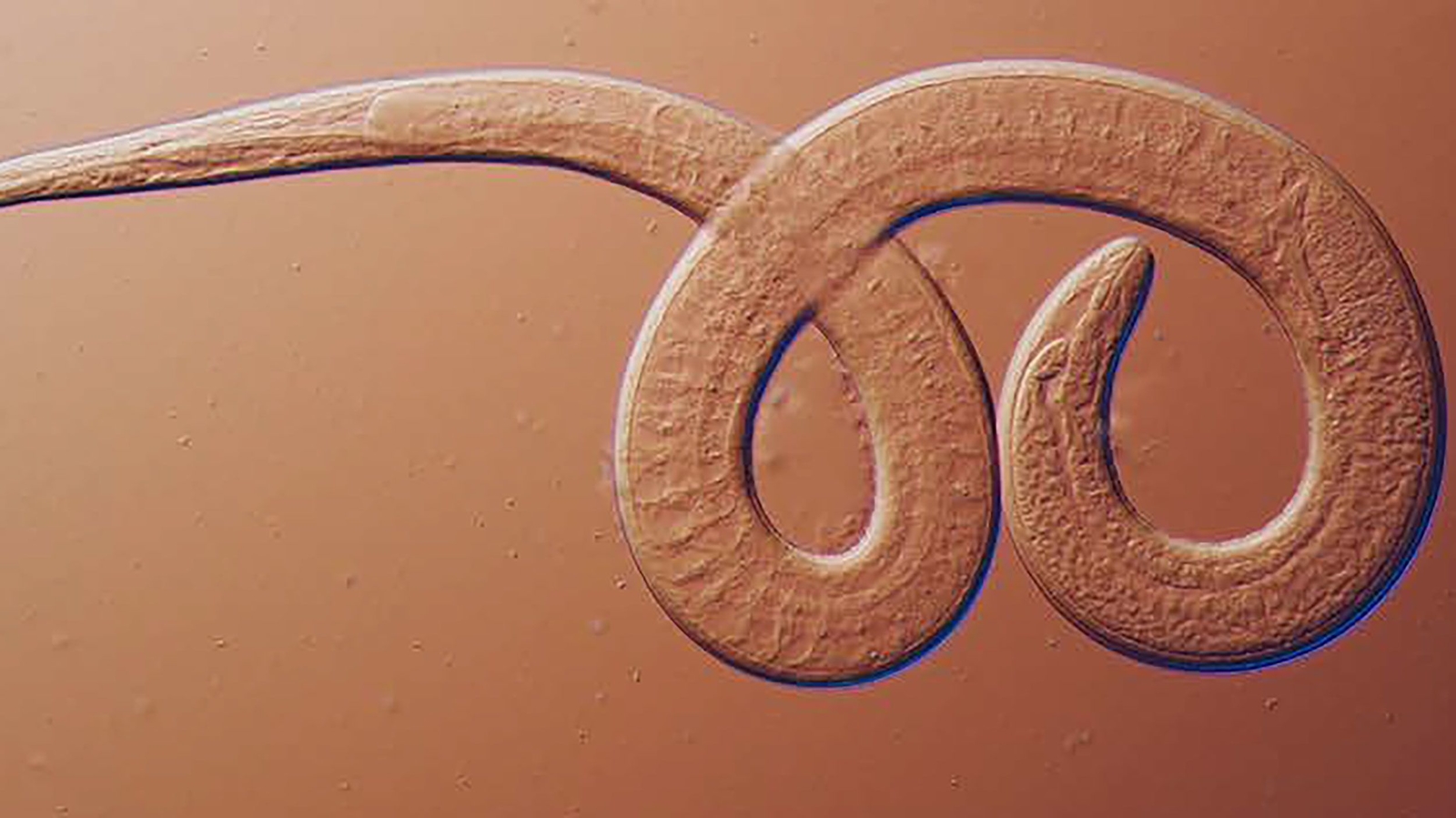 Featured image for Family Falls Ill from Undercooked Bear Meat, CDC Warns