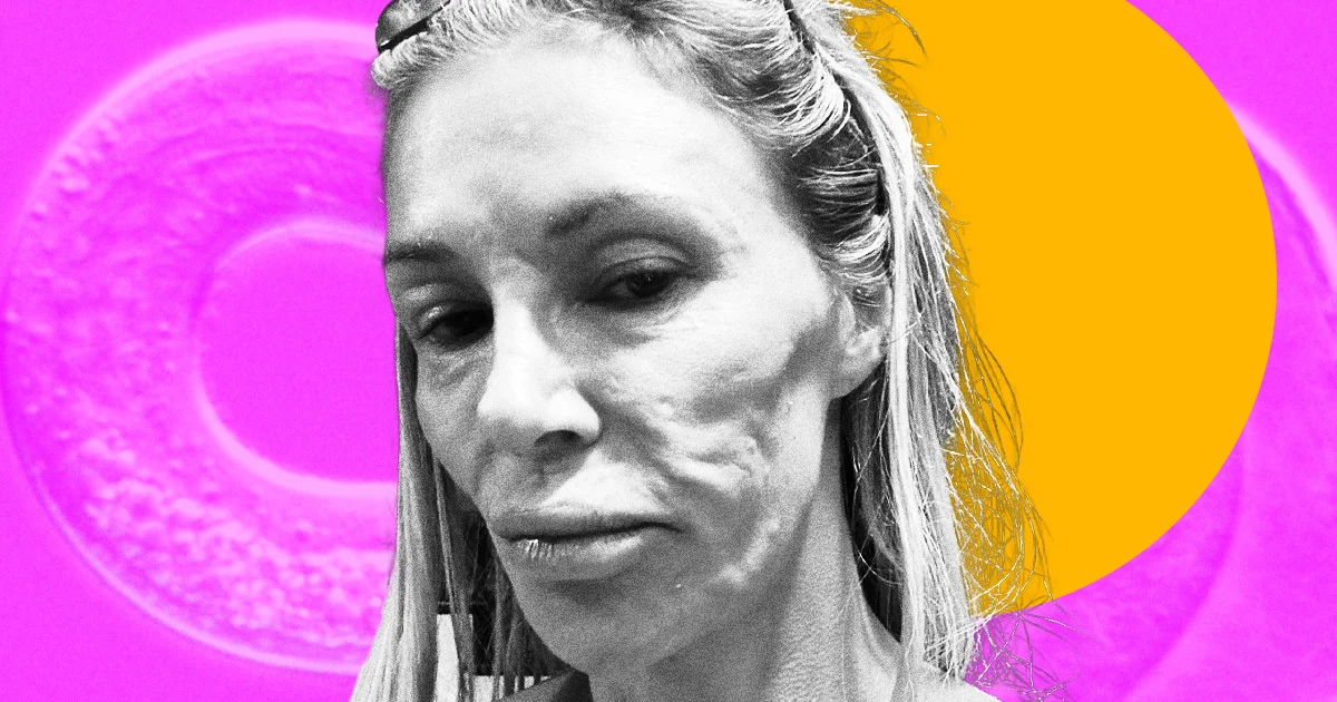 Featured image for Brandi Glanville's $70K Facial Ordeal: Parasite or Misdiagnosis?