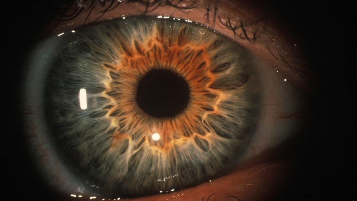 Featured image for The Evolutionary Significance of Blinking in Humans and Fish