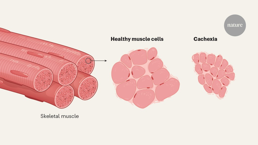 Featured image for Scientists Develop Drug to Counteract Cancer-Related Wasting