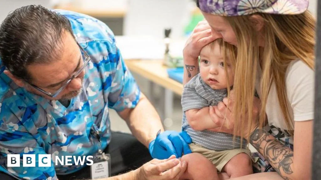South Carolina measles surge tests US elimination status