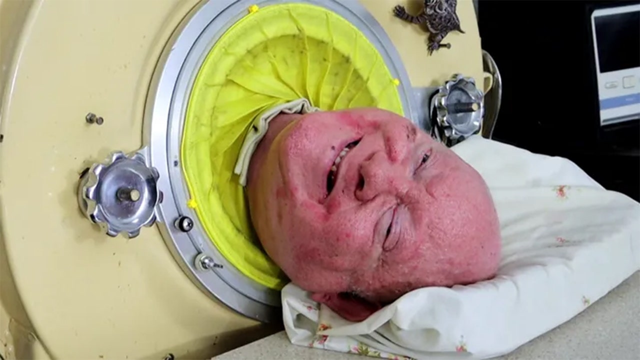 Featured image for "Longtime Iron Lung User Paul Alexander Dies at 78"