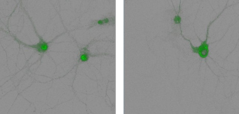 Enhancing Long-Term Memory Storage in Mice: The Key Process Unveiled