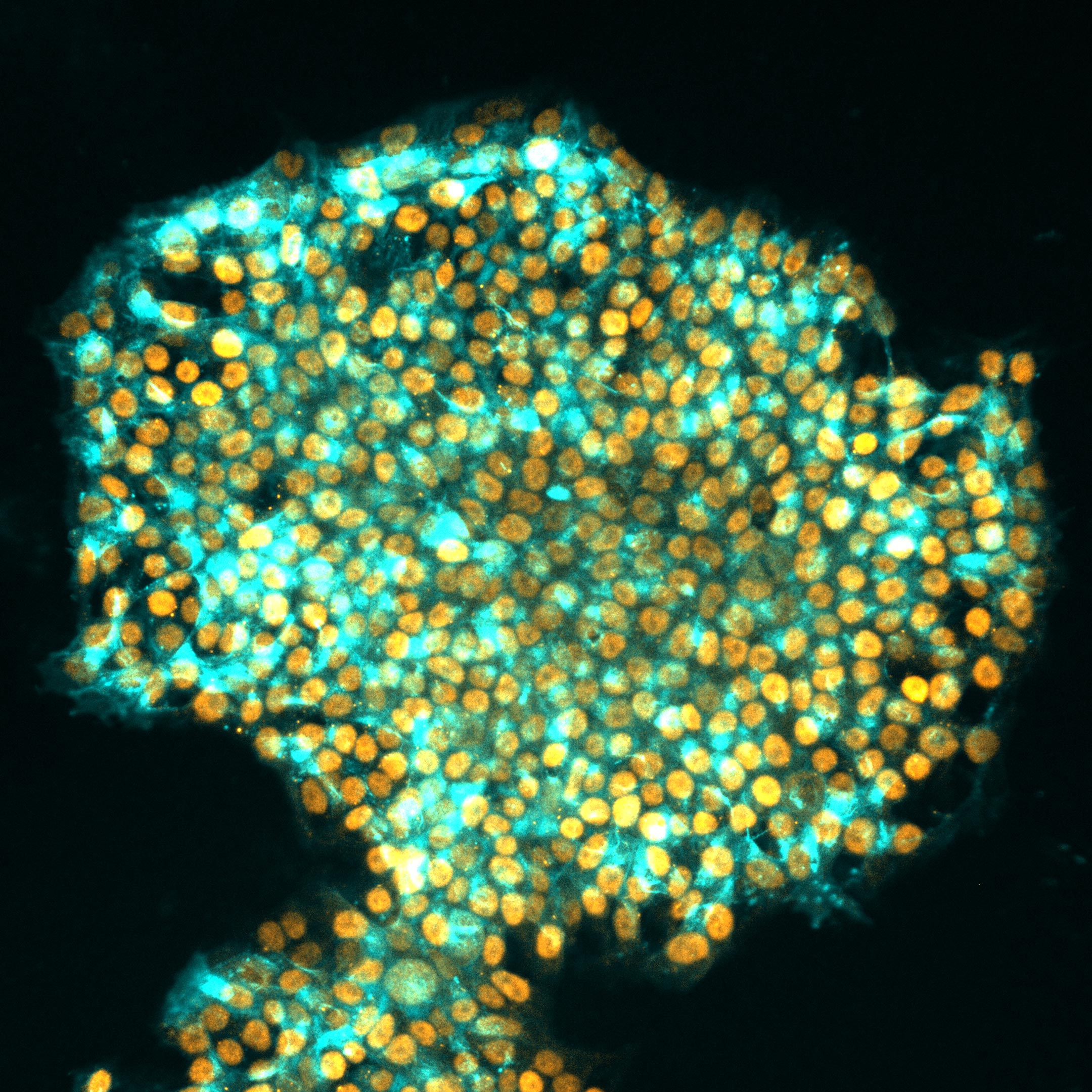 Revolutionary Cell Reprogramming Technique: Wiping Memory for Enhanced Stem Cell Therapy