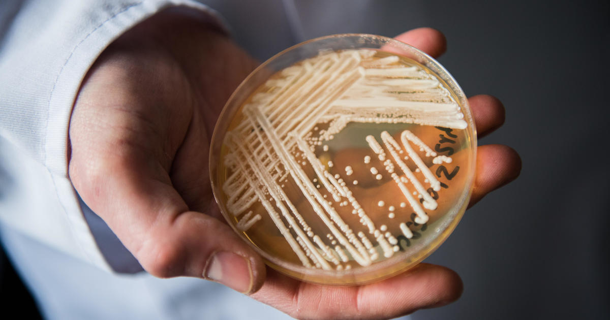CDC sounds alarm over deadly fungal infection spreading rapidly in US hospitals.