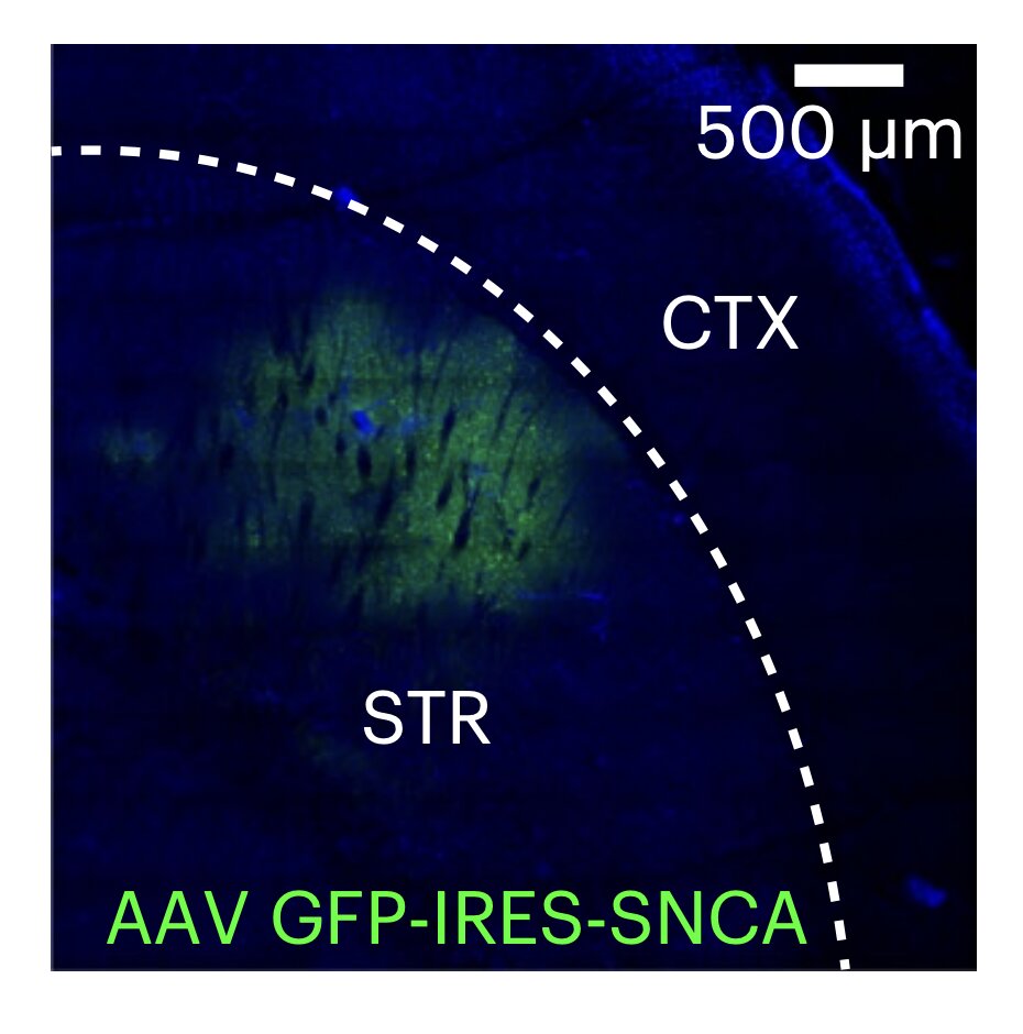 Featured image for Postsynaptic synucleins mediate endocannabinoid release, study finds.