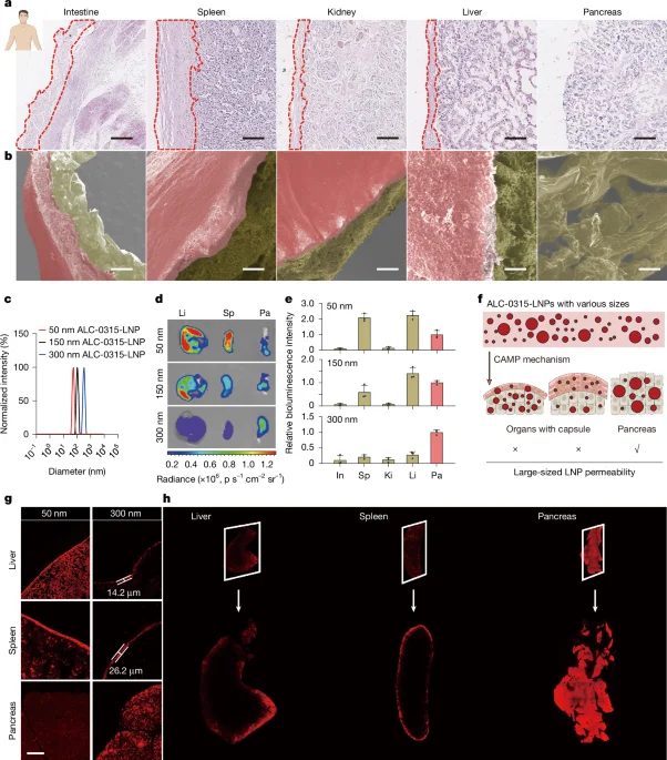 Capsule-Filtration-Enabled LNPs Target Pancreas for Precision mRNA Therapies