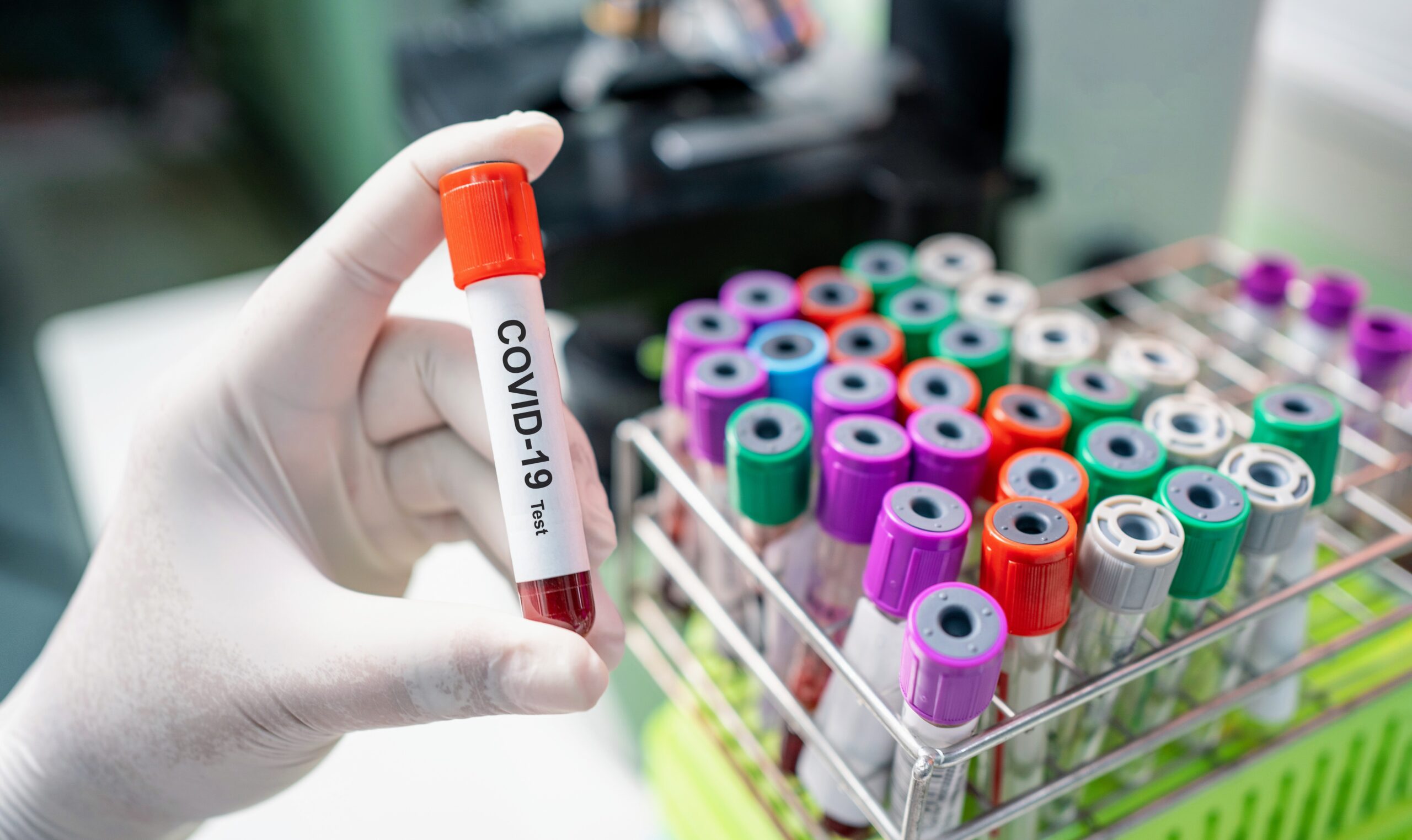 COVID-19's Impact on Mortality Rates Revealed: CDC Data