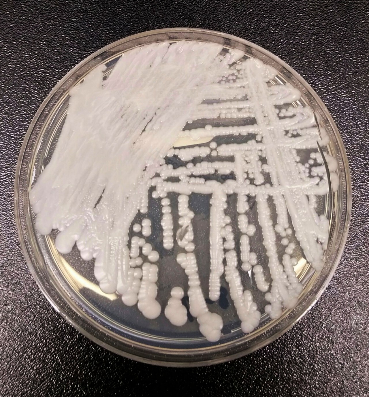 Featured image for The Deadly Spread of Candida Auris in the U.S.