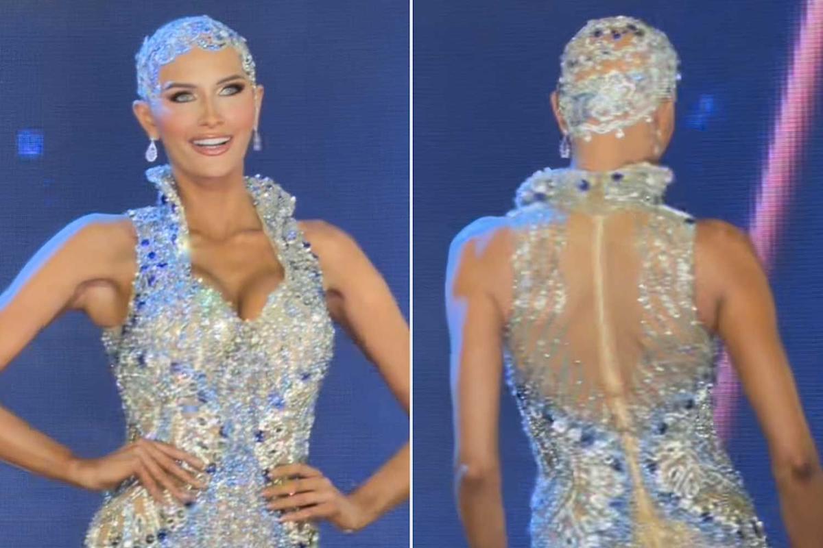 Featured image for Miss USA Contestant Embraces Alopecia in Bold Pageant Moment
