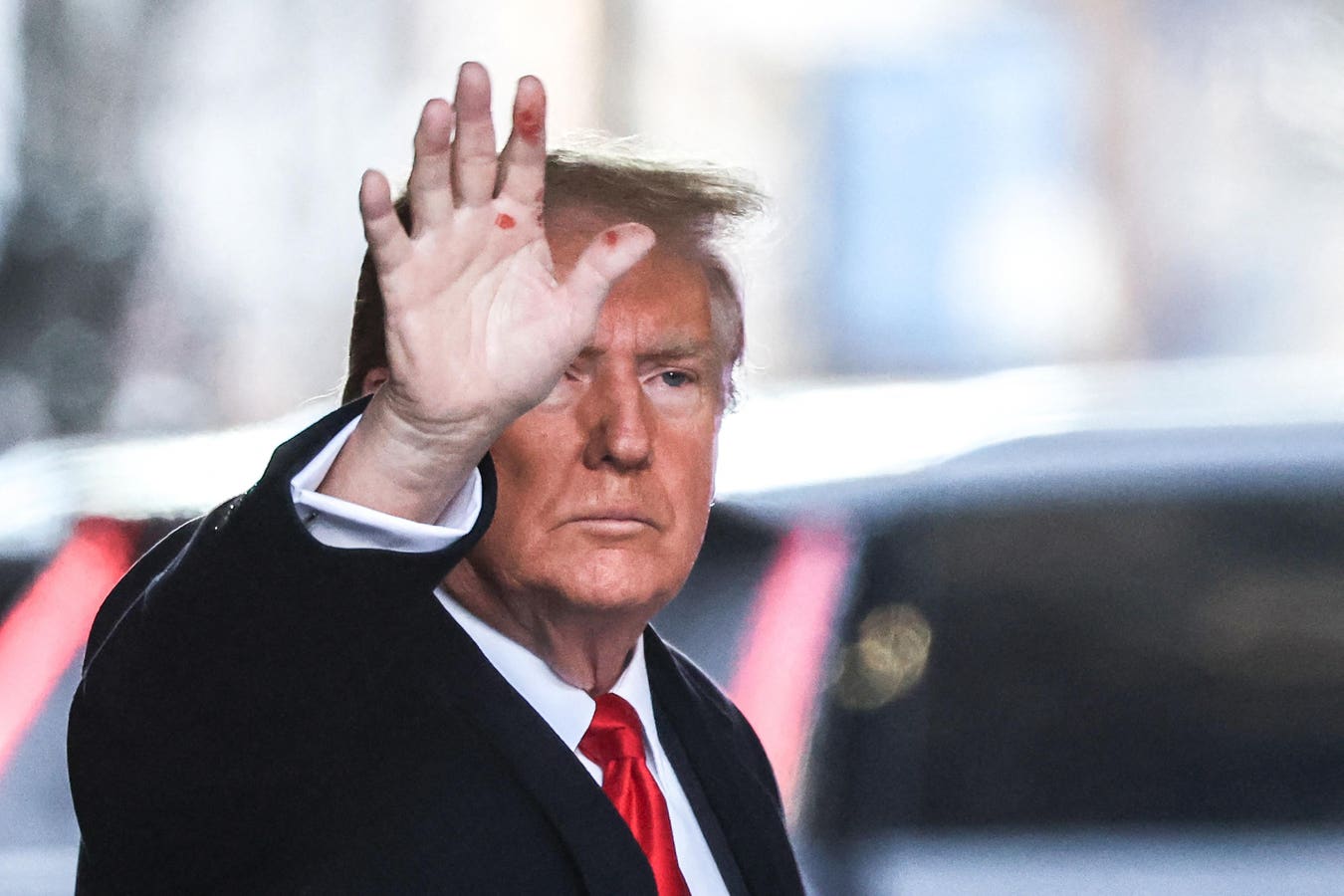 "Unraveling the Mystery of Trump's Red Hand Marks: Dermatologist's Insights and Syphilis Speculations"