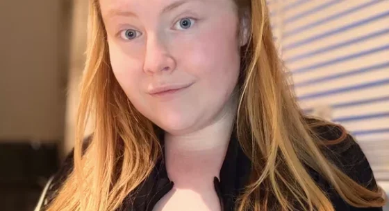 Rare gigantomastia keeps fueling breast growth despite weight loss