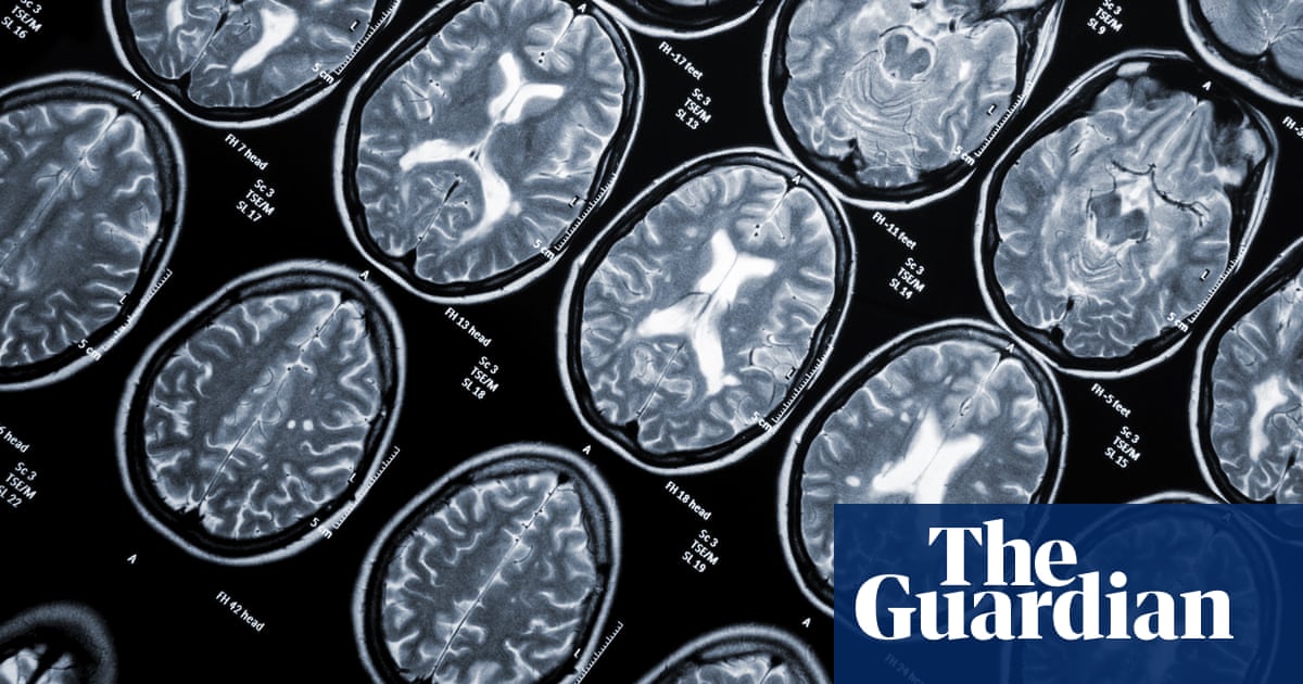 Featured image for "The Widespread Virus: Uncovering its Connection to Cancer and MS"