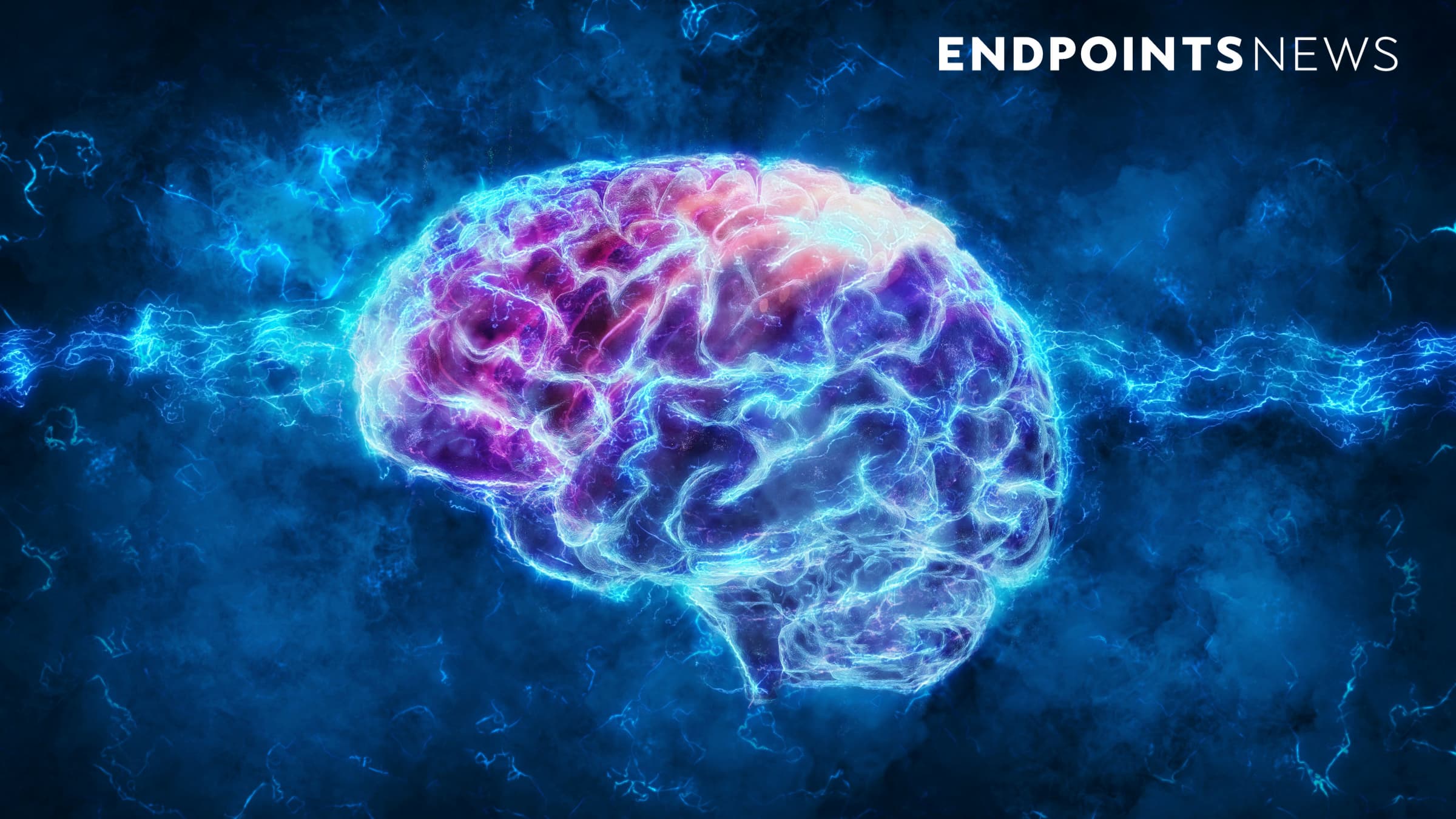 Featured image for "GLP-1 Diabetes Drug Shows Promise in Slowing Parkinson's Progression"