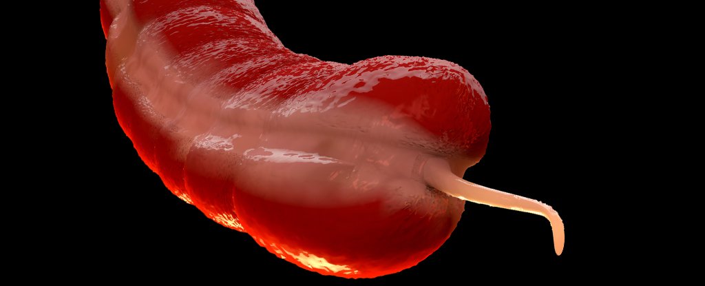 Featured image for Surge in Rare Appendix Cancers Among Millennials and Gen X