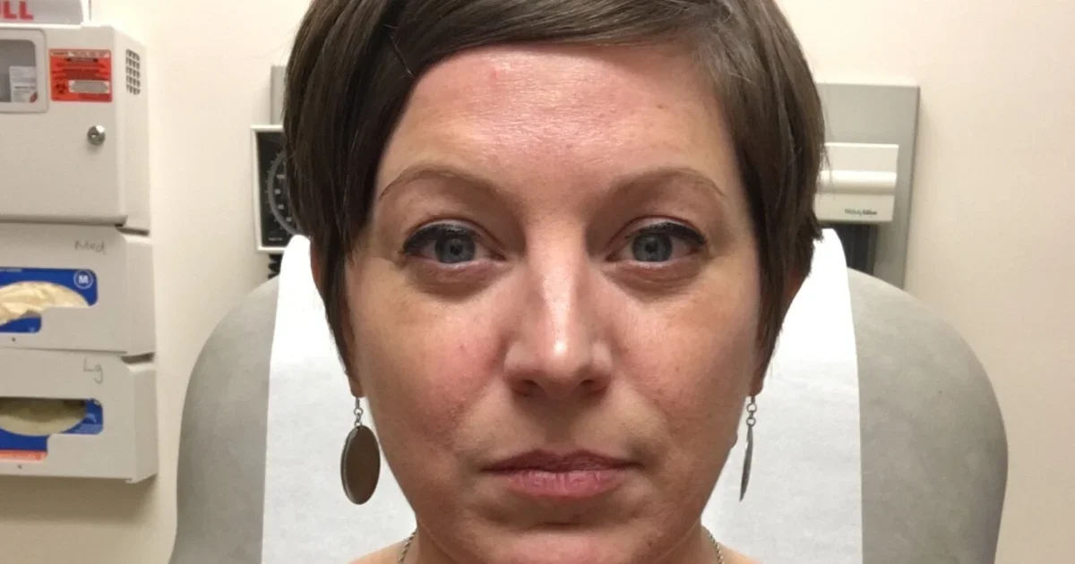 Hidden Clues, Big Fight: A Mom Beats Stage 3 Rectal Cancer