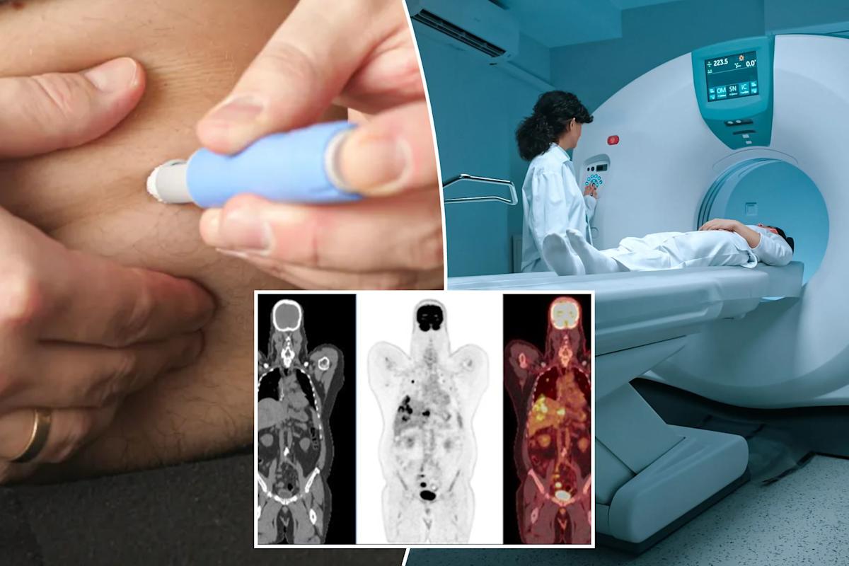 Featured image for Rare Side Effect of Ozempic and Similar Drugs on the Rise