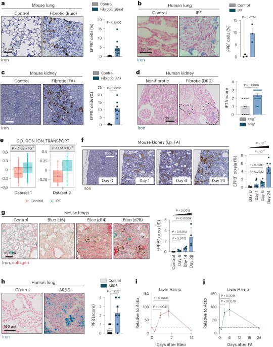 Featured image for The Role of Iron Accumulation in Fibrosis and Senescence