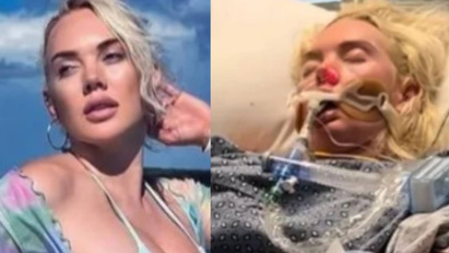 Featured image for "Terrifying Bahamas Trip: Atlanta Woman Loses Leg to Flesh-Eating Bacteria"