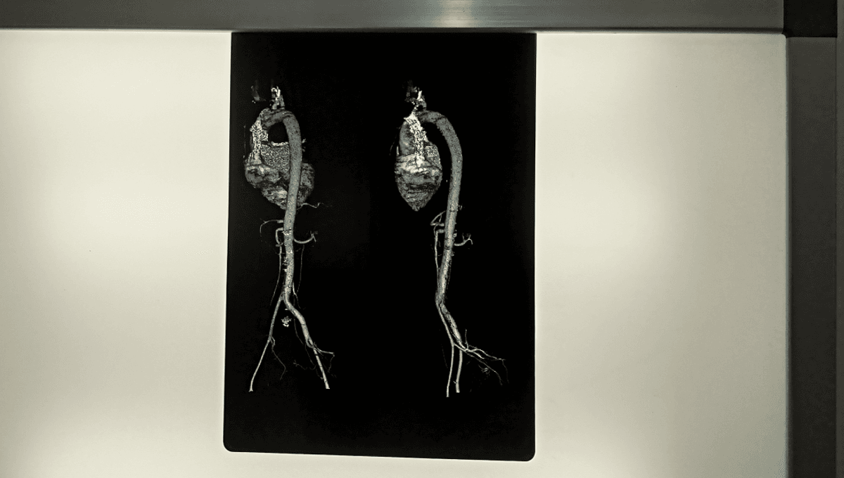 Featured image for Understanding the Varied Pace of Organ Aging and How to Slow It Down