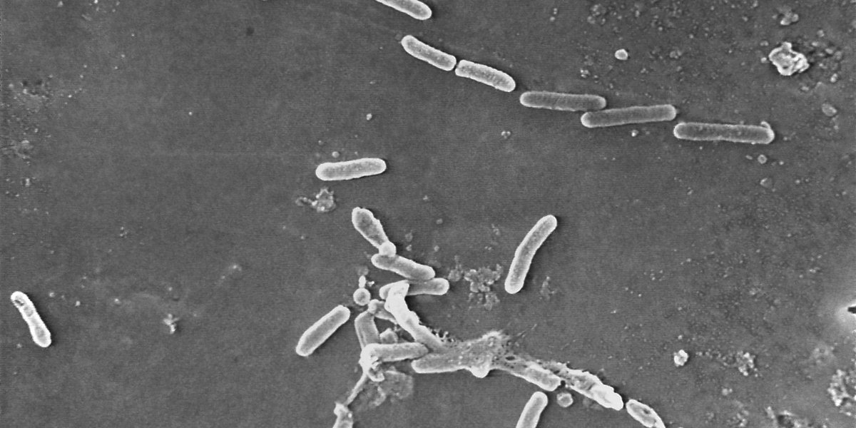 Featured image for Tainted Eye Drops Linked to Fourth Death and Vision Loss Cases, CDC Reports