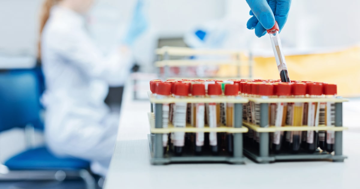 Featured image for "Uncovering the Stealthy Threat: Preventing Deadly Heart Attacks and Strokes Linked to Cholesterol"