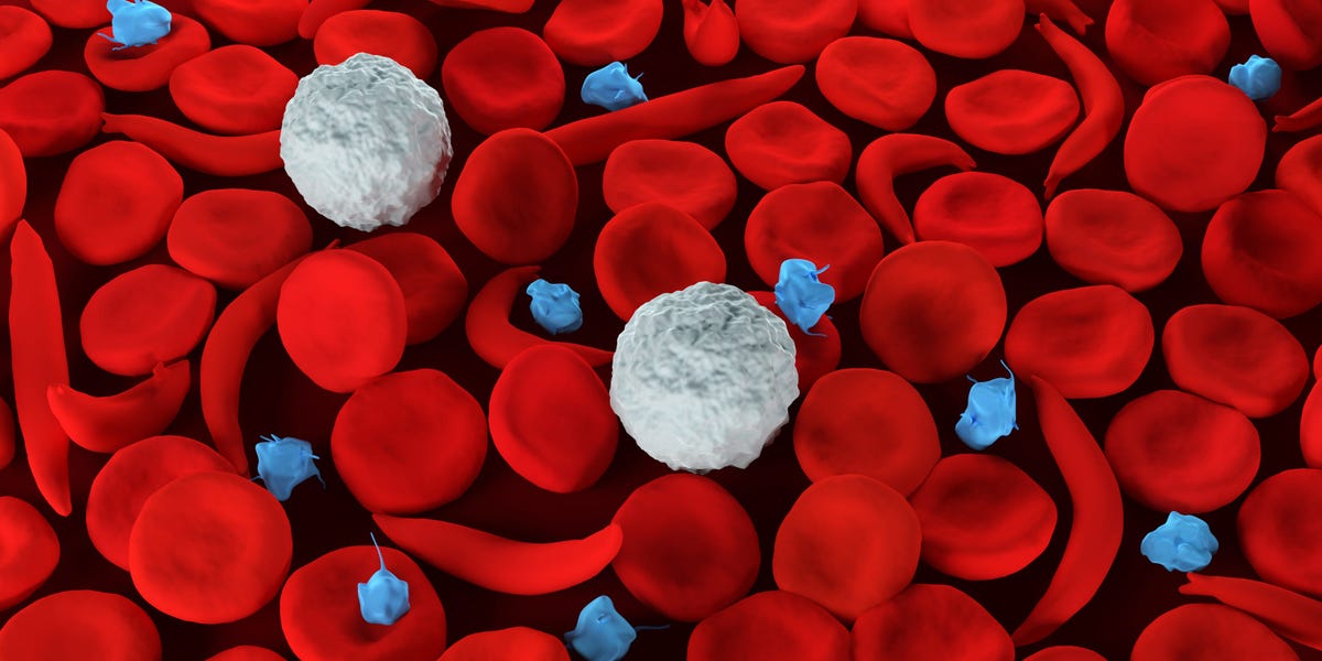 "FDA Approves Groundbreaking Gene Therapies for Sickle Cell Anemia, Paving the Way for a Cure"