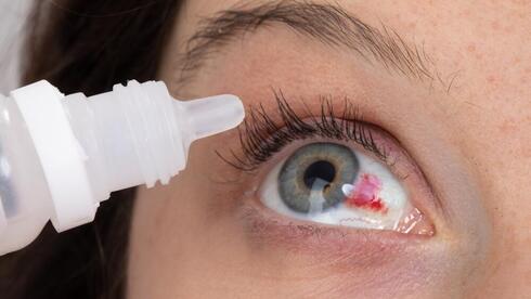 Featured image for Red Eye Spot: Commonly Harmless but Sometimes a Warning