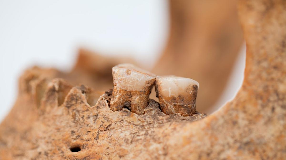 Featured image for Fossil Teeth Reveal Potential New Hominin Species and Complex Human Evolution