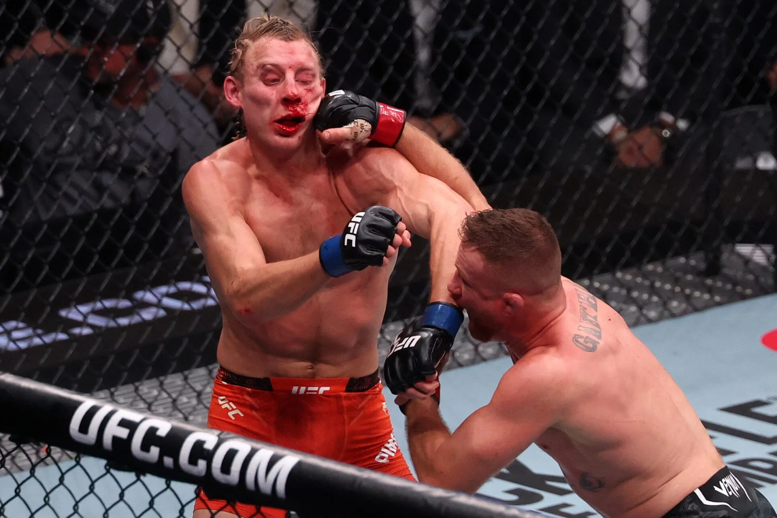 Pimblett speaks out after brutal UFC 324 clash and hospitalization