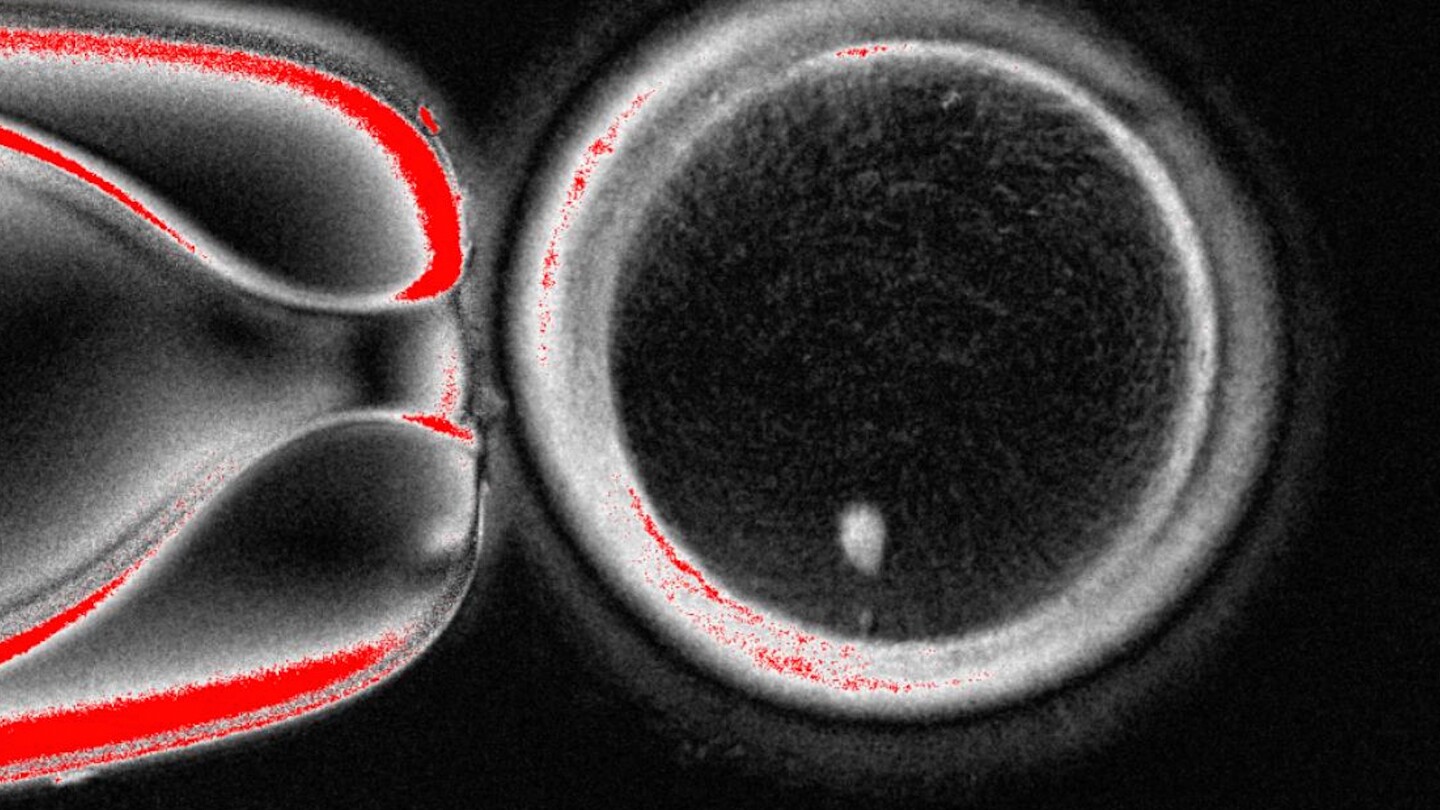 Featured image for Scientists Achieve Lab-Made Human Eggs from Skin Cells
