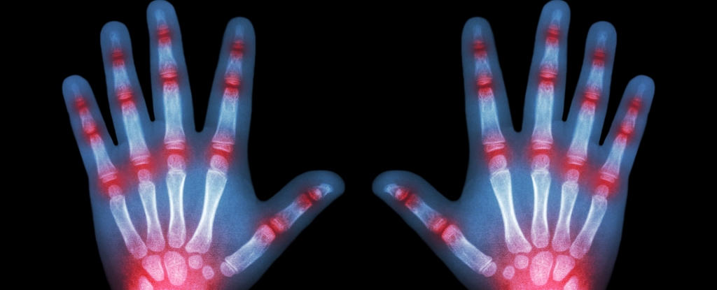 "Crucial Advice for Kids Battling Arthritis"