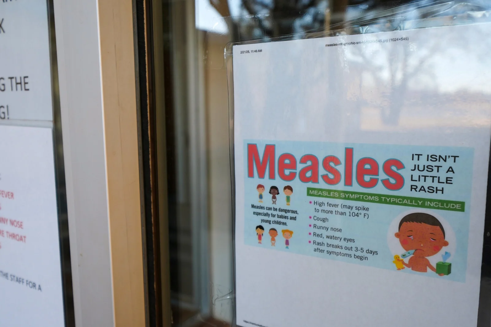 Possible measles exposure linked to Bethesda office building