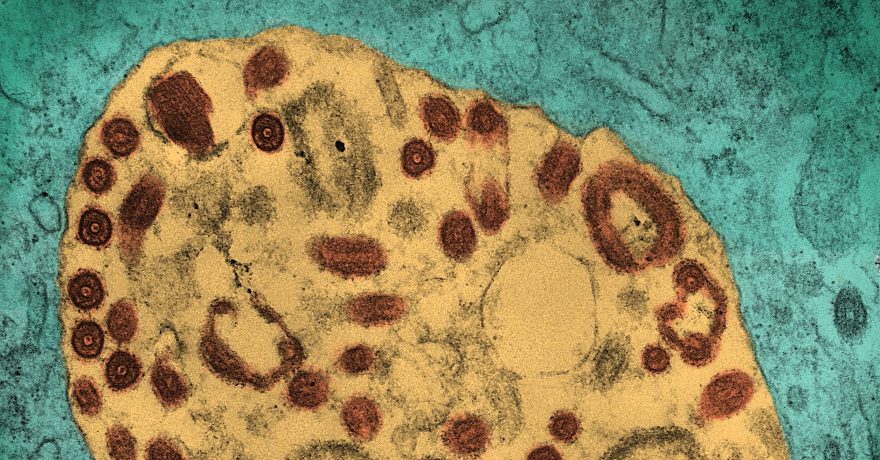 Marburg Virus Outbreak Raises Concerns in Africa and Beyond.