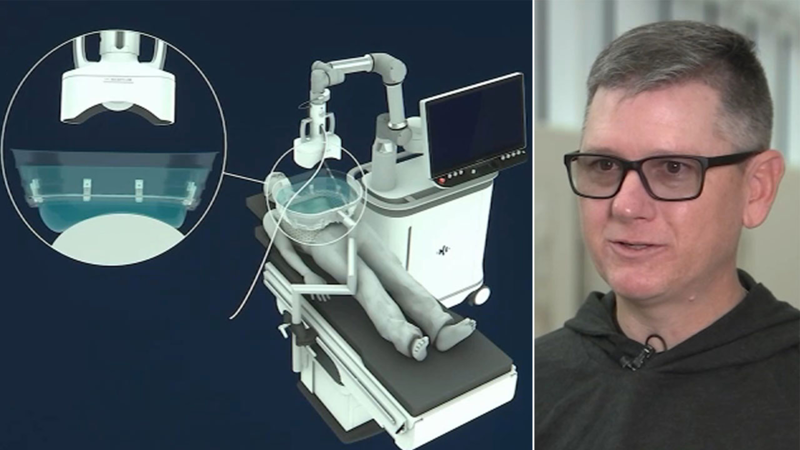 Featured image for Revolutionary Cancer Treatments: Sound Waves, AI, and Precision Medicine