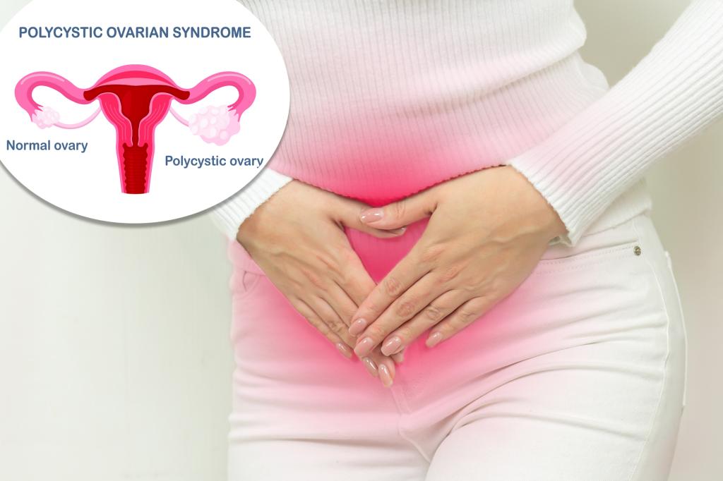 Featured image for "Heightened Suicide Risk in Women with Polycystic Ovary Syndrome"