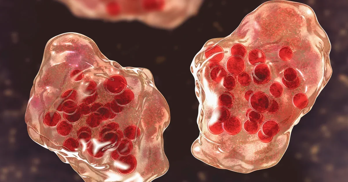 Orange County logs second measles case tied to Disneyland visit