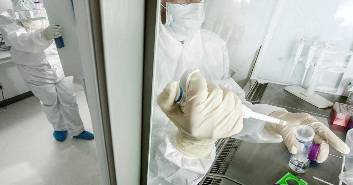 Featured image for "Unraveling the Origins of Multiple Sclerosis Through Ancient DNA Analysis"