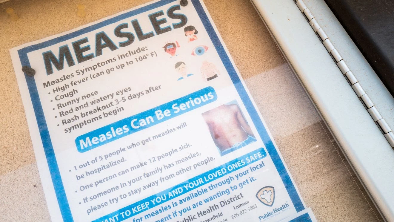 Featured image for First Measles Case Reported in Summit County Student