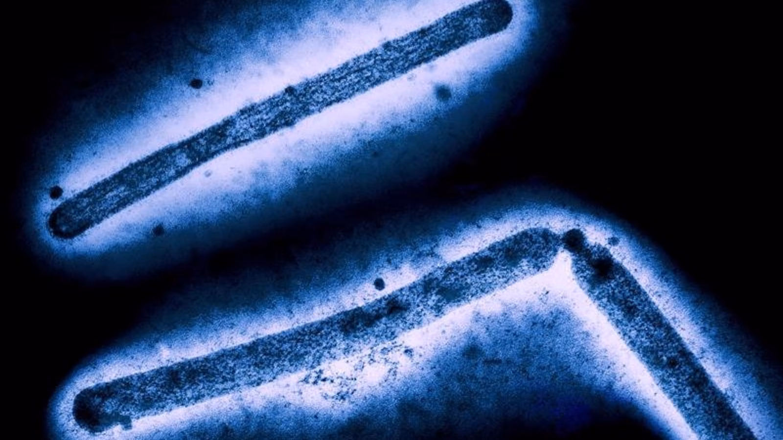 Featured image for Bird Flu Threatens US Health System Amid Flu Season