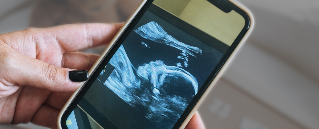 Featured image for Uncovering the Prenatal Origins of Anxiety