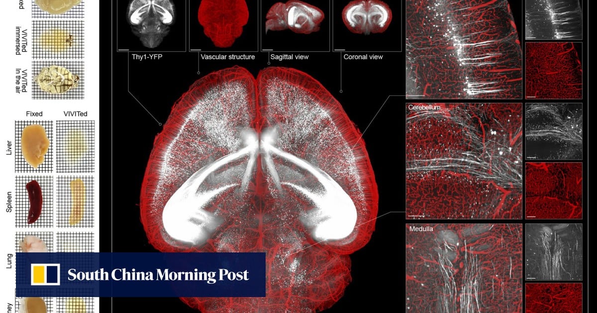 Featured image for Chinese scientists develop innovative 'ionic glass' technique for 3D transparent brain and organ imaging
