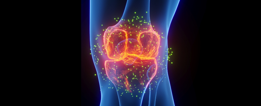 Featured image for Expert Reveals Exercise as Key to Easing Joint Pain