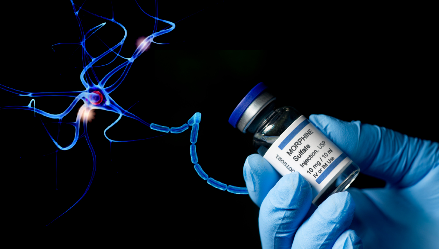 Featured image for "Myelination's Role in Opioid Addiction Learning"