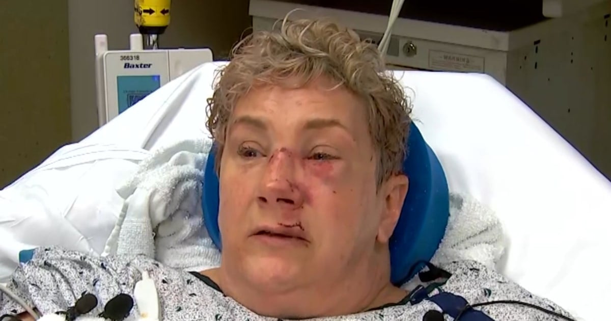 Pennsylvania Woman Survives Terrifying Bear Attack While Walking Dog