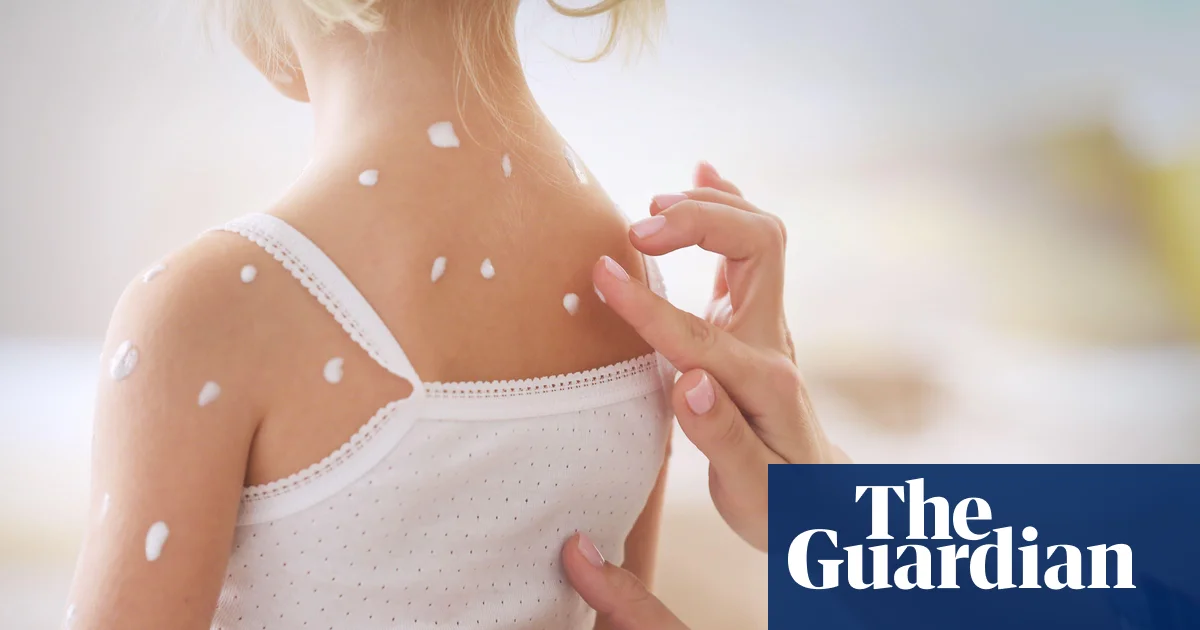 Seeing Illness Triggers Immune Response, Study Finds