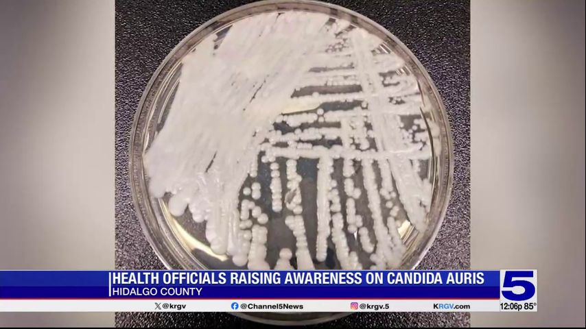 Featured image for Valley Health Monitors Deadly Fungal Infection Cases