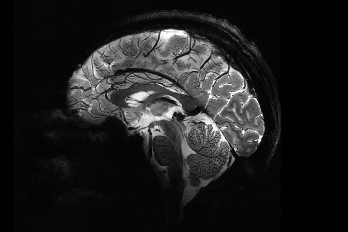 Revolutionary MRI Captures Unmatched Brain Images